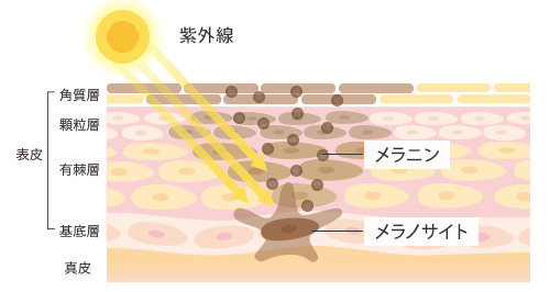 もともと紫外線に弱い